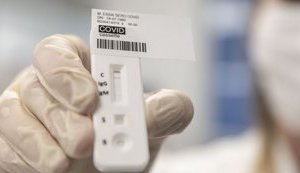 Health Ministry To Increase Number Of PCR-Tests To 8,000-10,000 Per Day