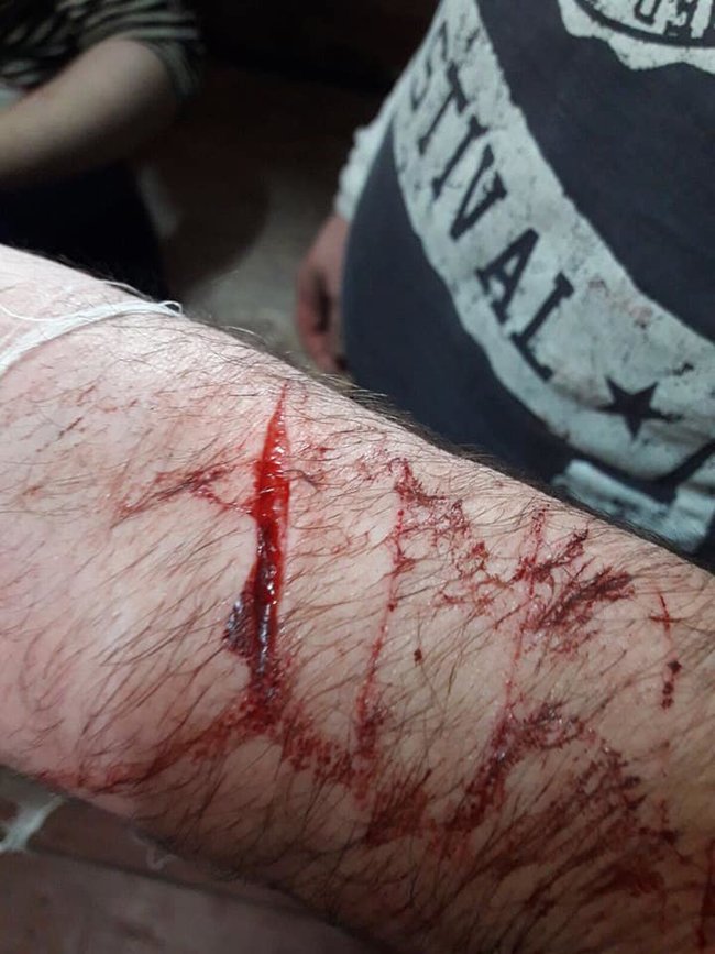 В СИЗО Черновцов произошел бунт из-за больного коронавирусом, - Денисова 04