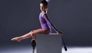 Little gymnast Oleksandra Paskal, who lost her leg as result of Russian shelling, continues to practice her sport. PHOTO