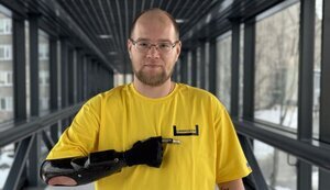 Захисник України Шикун, який отримав біонічний протез руки, планує повернутися на фронт. ФОТО