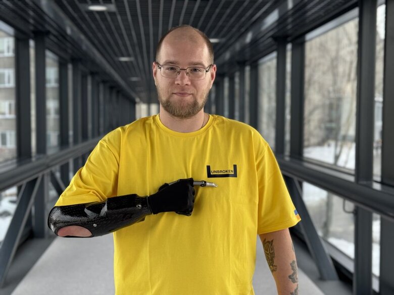 Захисник України Шикун, який отримав біонічний протез руки, планує повернутися на фронт 01