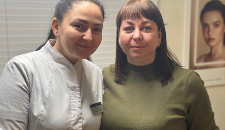 Svitlana, Psychologist of 61st Brigade: "Year ago, Iskander missile struck building in Pokrovsk. My face was so lacerated that I told my comrades-in-arms: I don’t have face anymore"
