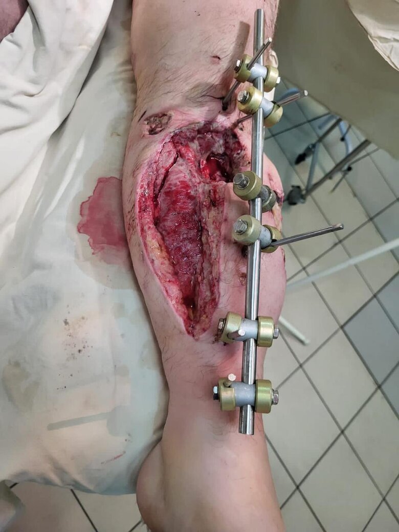 Командир прикордонної застави вогневої підтримки Андрій Соломонюк: Почав по танку з автомата стріляти, щоб перемкнути увагу на себе і дати хлопцям час вийти з будівлі. Дивлюсь – башточка повертається, далі нічого не пам’ятаю 04