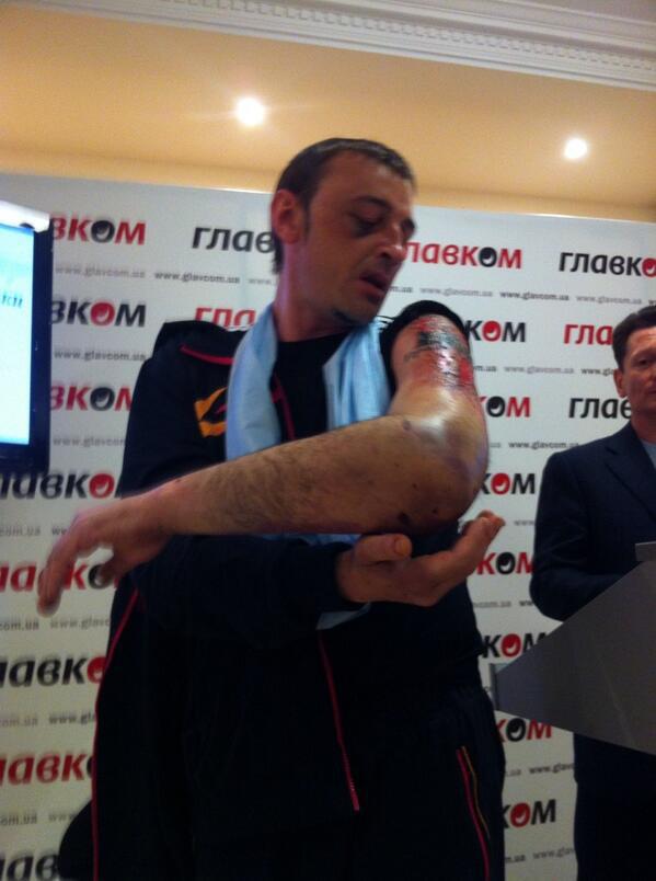 шахтер пытки