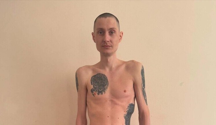 1037 days and minus 40 kilograms: National Guard soldier Petrovskyi before and after Russian captivity. PHOTO