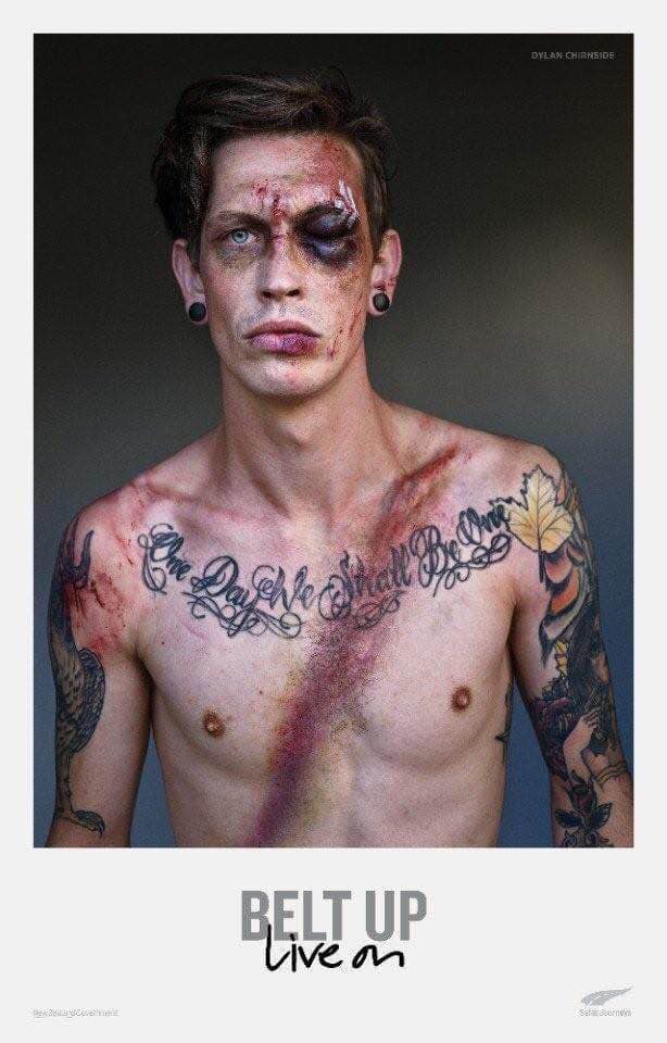 Пристегивайся. Живи: в Новой Зеландии выжившие в ДТП рассказали о пользе ремня безопасности 04