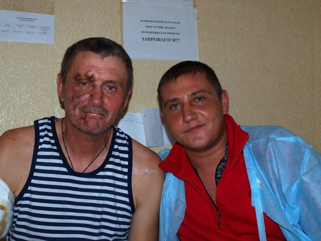 Заступник міністра у справах ветеранів, колишній гранатометник, Олександр Терещенко: Побачив гранату РГД-5 без чеки, яку щойно закинули сєпари. Намагався її викинути, але вона вибухнула 05