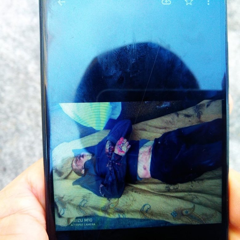 Тело Василия было изувечено, лица не было, кисти рук раздроблены, страшные гематомы, ребра неестественно вывернуты, - житель Бучи Тарасевич дал показания по поводу преступлений россиян 01