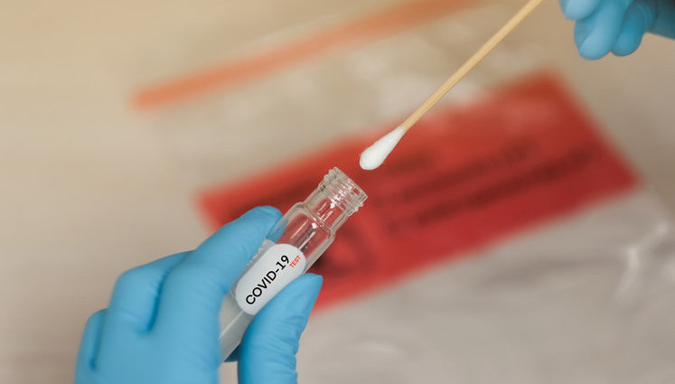 Тестирование на COVID-19 следует делать в случае любых симптомов вирусного заболевания, - Кузин. ВИДЕО