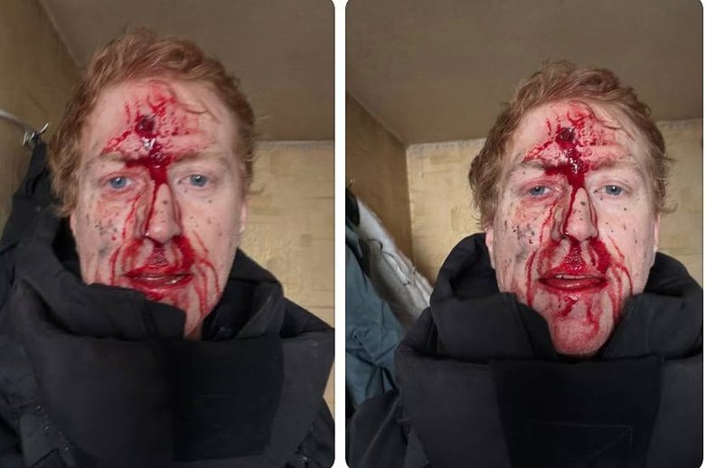 Волонтер Денис Христов попал под обстрел РФ