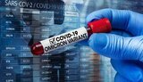Глава Минздрава ЮАР Пхаала о штамме "Омикрон": Этот вариант действительно быстро распространяется, но не вызывает тяжелого течения COVID-19 у вакцинированных