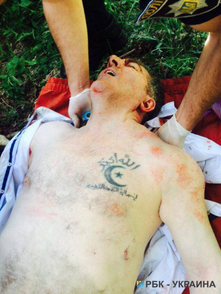 В Киеве пытались убить патриотов-добровольцев Адама Осмаева и Амину Окуеву 02