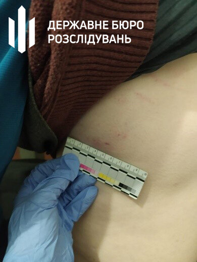 В Киевском СИЗО умер заключенный после избиения