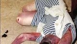 наркомания наркоманы