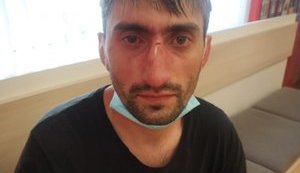 Антимайданівця Топаза побили в Києві. ФОТО