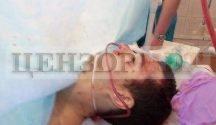 Фотографії вбивці Вороненкова Паршова під час операції незадовго до смерті. ФОТО 18+