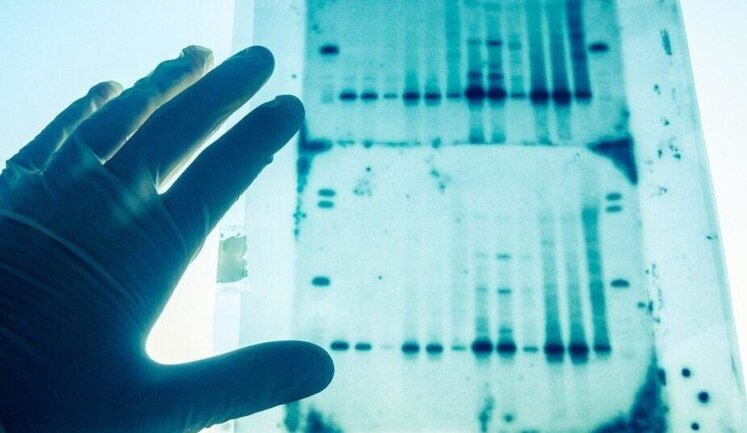 In Ukraine, procedure for DNA selection from volunteers was approved