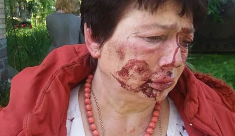 Head of Kotsiubynske territorial election committee Demchenko beaten by 'titushkas'; prosecutor general says will control investigation. PHOTO