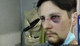 Трьом поліцейським, які побили ветеранів АТО у Львові, повідомили про підозру в хуліганстві