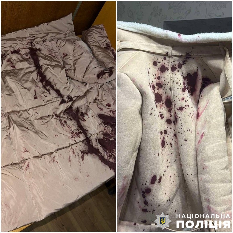Cyclist rode through Kyiv’s Podil and poured red paint on people. He was detained 02