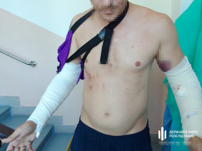 побиття військового на Кіровоградщині