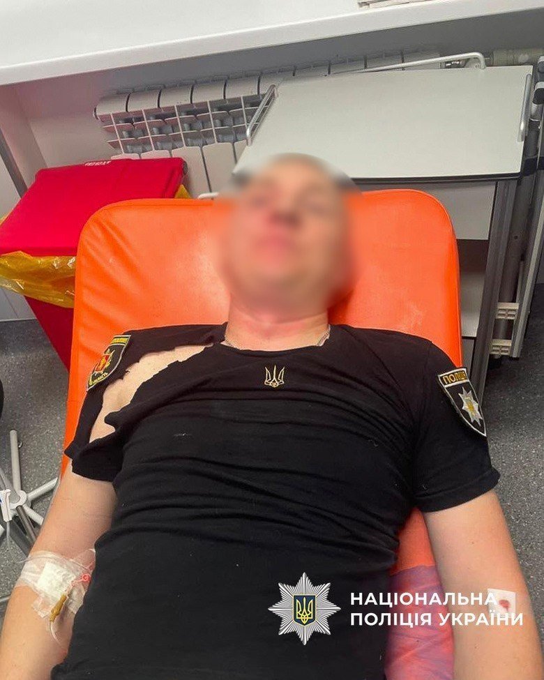 у Запоріжжі підозрюваний атакував поліцію під час обшуку