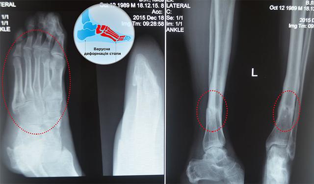 реабилитация