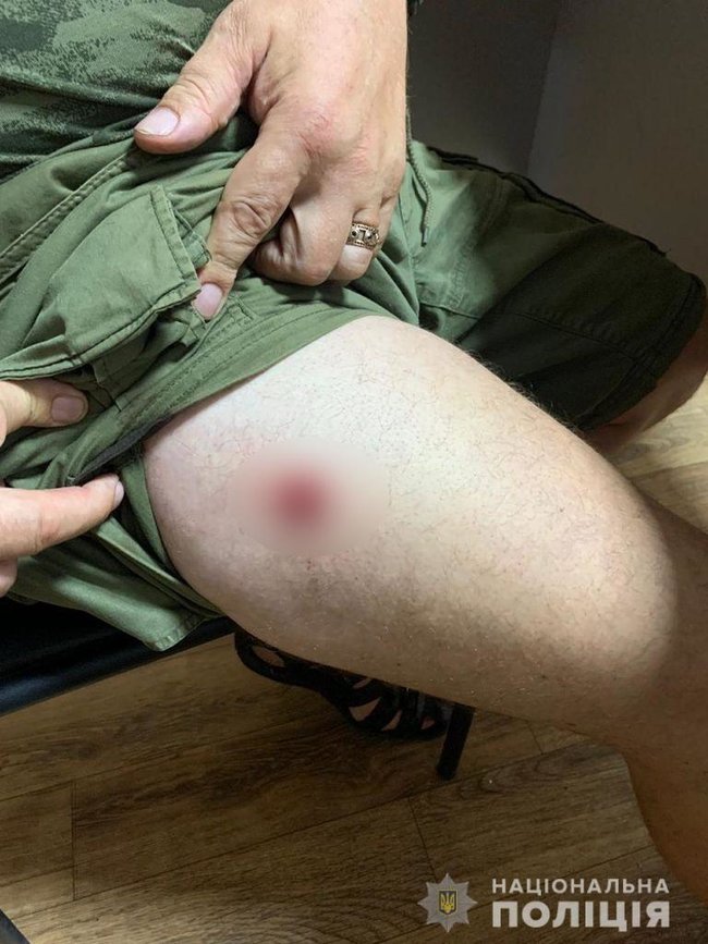 Двоє чоловіків влаштували стрілянину в цирку у Василькові на Київщині, - Нацполіція 02