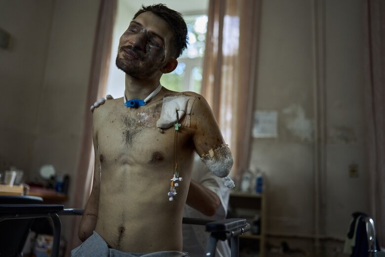 Wife in hospital hugs her husband, soldier of 47th brigade Andrii, who lost his hands and sight in battle against invaders 06