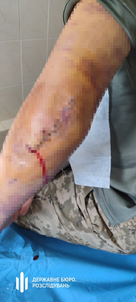 побиття військового на Кіровоградщині