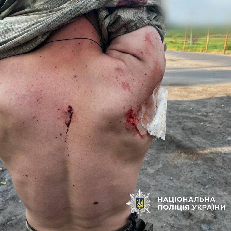 постраждалі