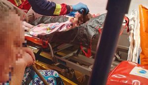 6-річна дитина постраждала внаслідок ворожого обстрілу Куп’янська