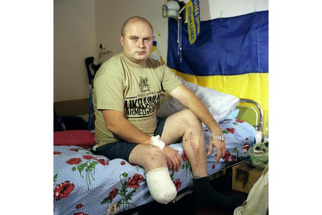 Проект українського фотографа Чекменьова зі знімками поранених воїнів зібрав близько $ 400000 для їх лікування і підтримки 13