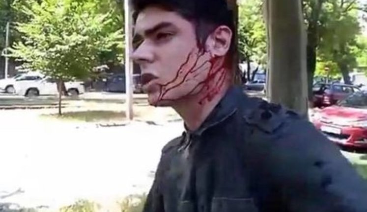 Нападение на активиста "Автомайдана" Устименко: дело переквалифицировали в хулиганство, а обвиняемым дали условный срок