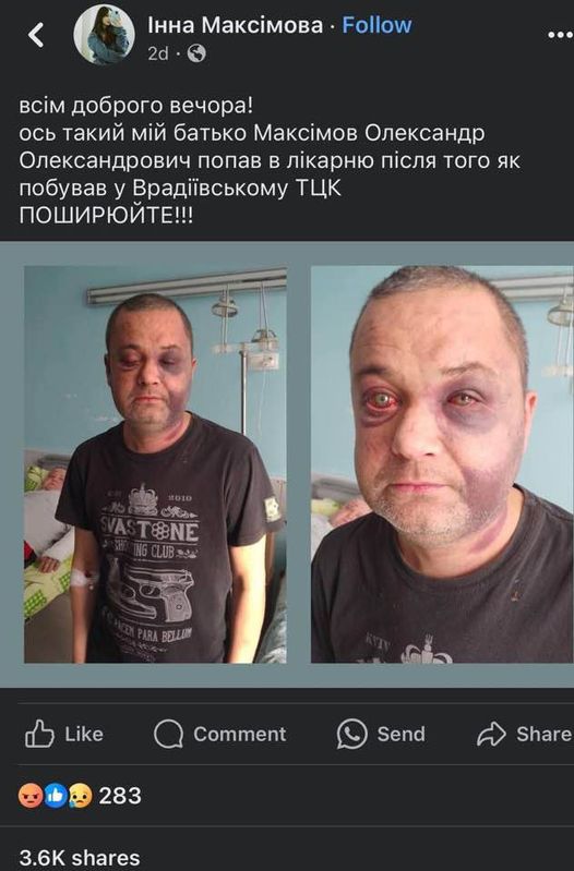 Олександр Максімов після ймовірного побиття у ТЦК