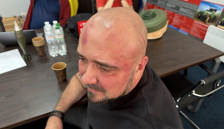 SSU officers beat Ukrainian Armor first deputy director in his own home – company statement