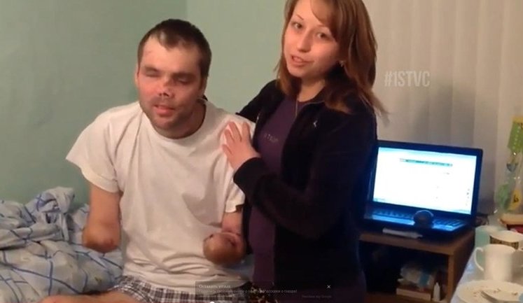 Российский боевик из банды Мозгового Александр Науменко лишился рук и зрения. СТРАШНОЕ ВИДЕО