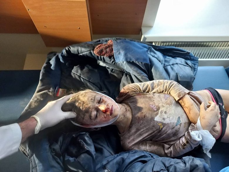 Since Russian invasion in Ukraine, 52 children died 02