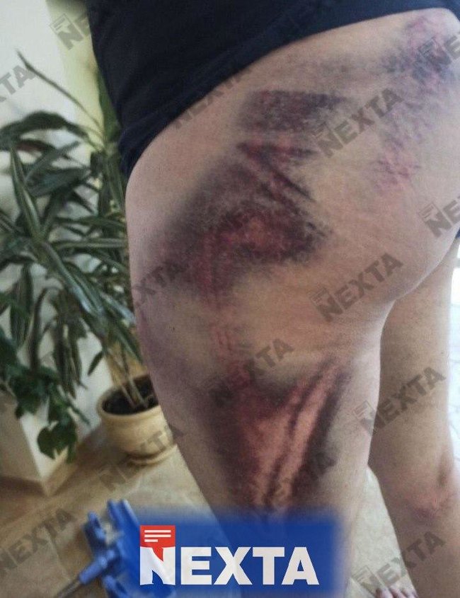 Зверства белорусского ОМОНа: жуткие кадры пыток задержанных 06