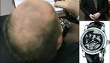 "Регионал" Иванющенко носит часы за полмиллиона долларов. ФОТО