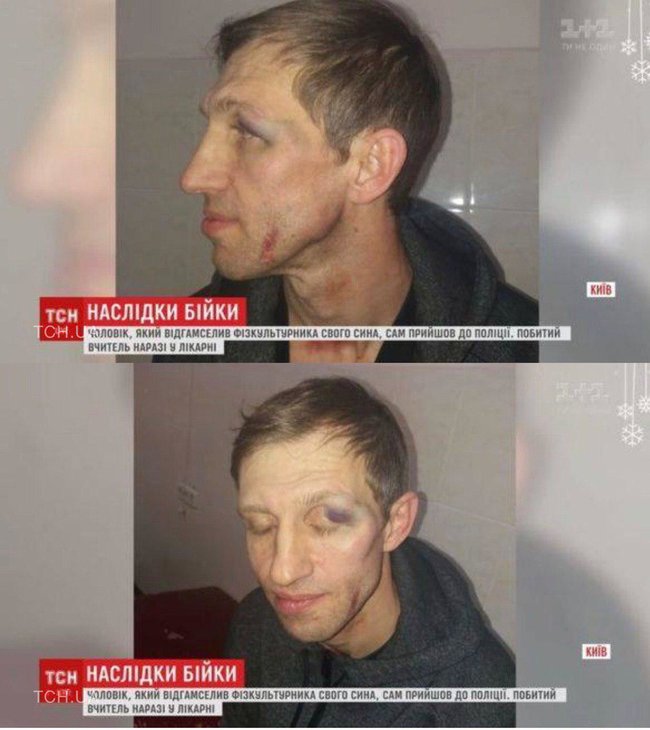 Батько київського ліцеїста побив вчителя фізкультури за зауваження синові: педагог у лікарні, чоловік у СІЗО 01