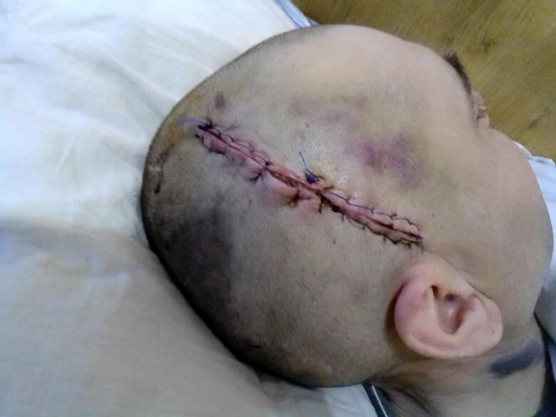 Офіцер на Волині жорстоко побив солдата. Той в лікарні: відмовили ноги 01