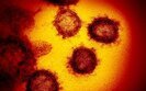 Ukraine reports first coronavirus death