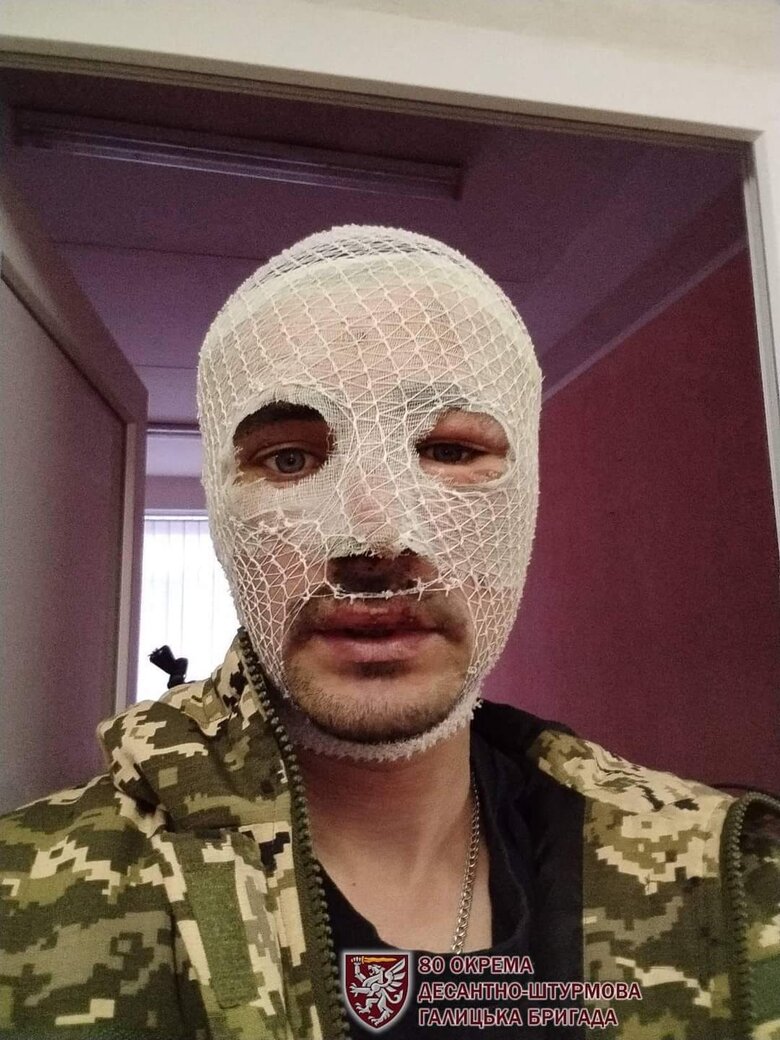 Воїн 80 ОДШБр Псих