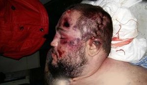 Родственники рассказали об убийстве осужденного Андрея Данилюка в Хмельницком СИЗО: "Нанесли 13 ударов молотком по голове". ФОТОрепортаж