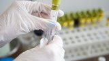 В Украине подтверждены еще два новых случая коронавируса в Черновицкой области