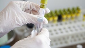Ukraine records five cases of coronavirus