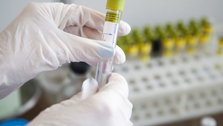 Ukraine records five cases of coronavirus