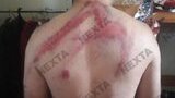 У мережі показали наслідки побиття одного із затриманих на акціях протесту в Білорусі. ФОТОрепортаж