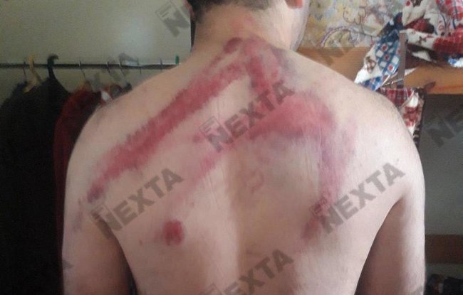 Зверства белорусского ОМОНа: жуткие кадры пыток задержанных 07